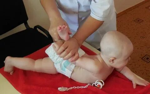 Детский массаж при дисплазии тазобедренного сустава